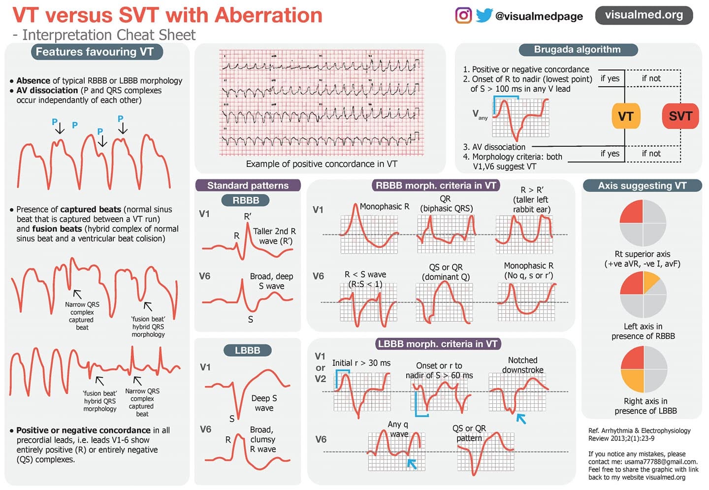 vt vs svt