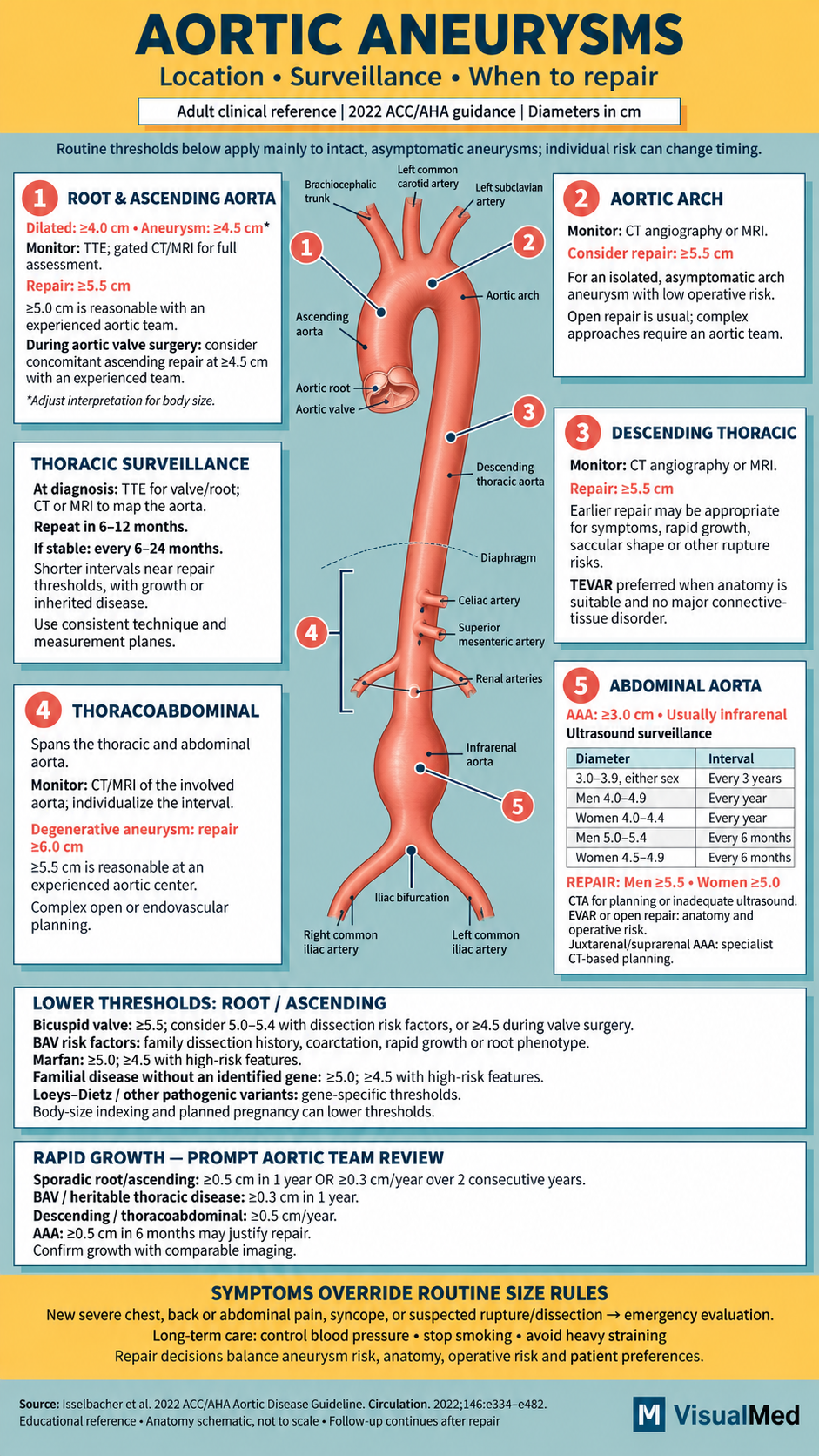 aortic aneurysms infographic